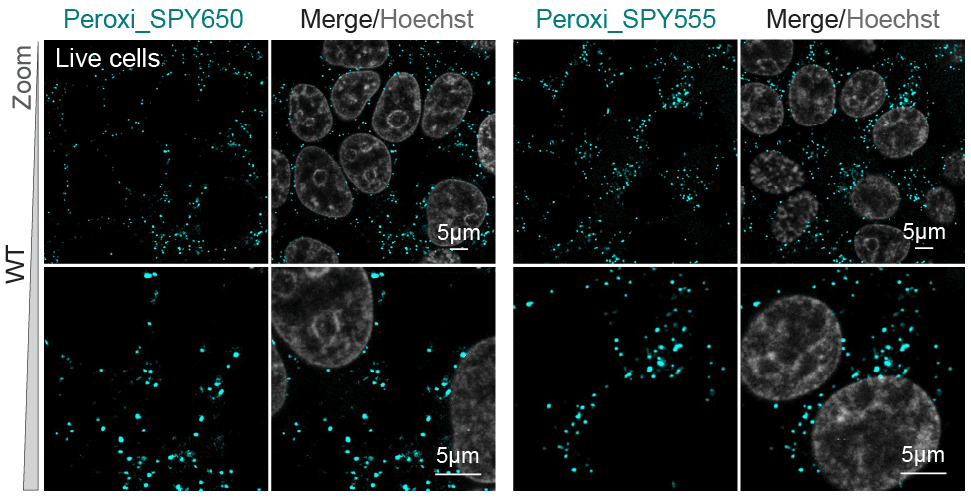 Peroxi SPY555 and 650 HEK cells hoechst