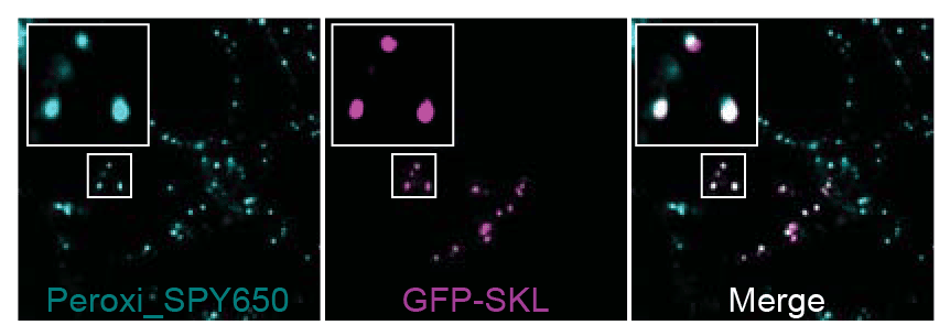 Peroxi SPY650 GFP-SKL colocalisation