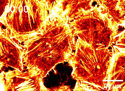 Peroxi SPY650 GFP-SKL colocalisation