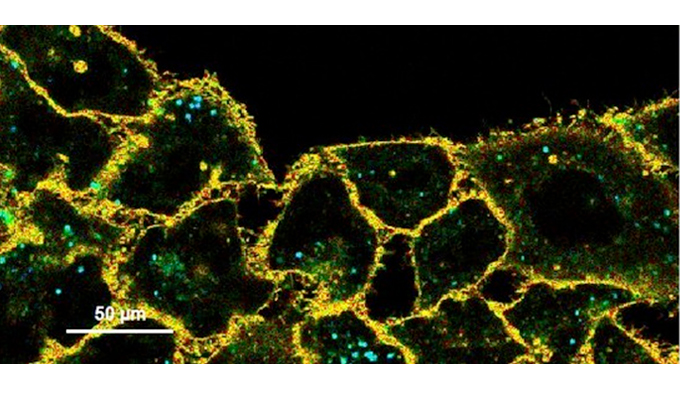 New Flipper-TR probes - easily measure membrane tension in cells