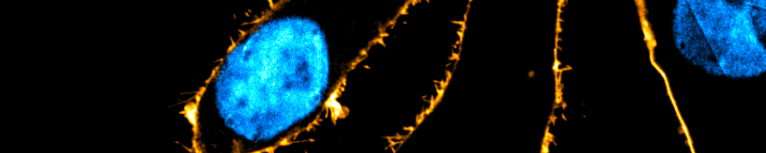 pkmem Spirochrome probe fluorescent image microscopy